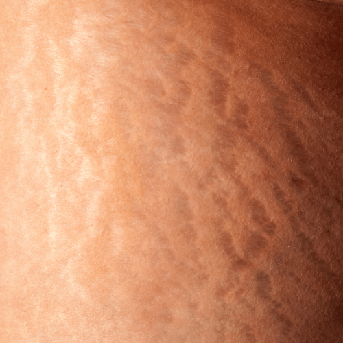 COREXAFlex - 3D compression leggings