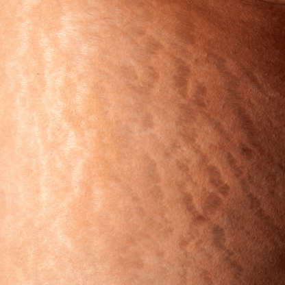 COREXAFlex - 3D compression leggings