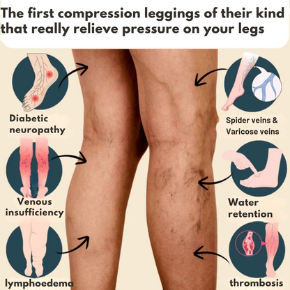 COREXAFlex - 3D compression leggings